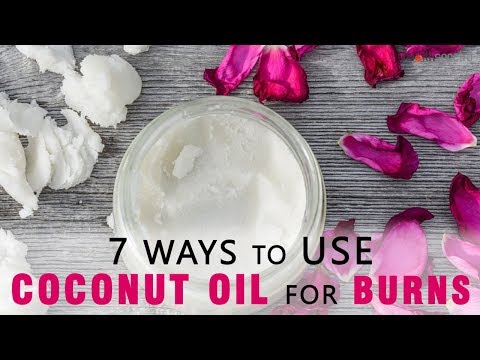 7 Ways to Use Coconut Oil for Burns