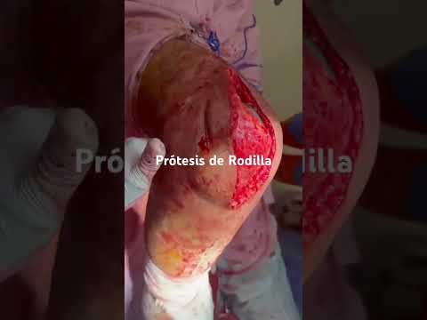 Carlos Tapia Hernández-21