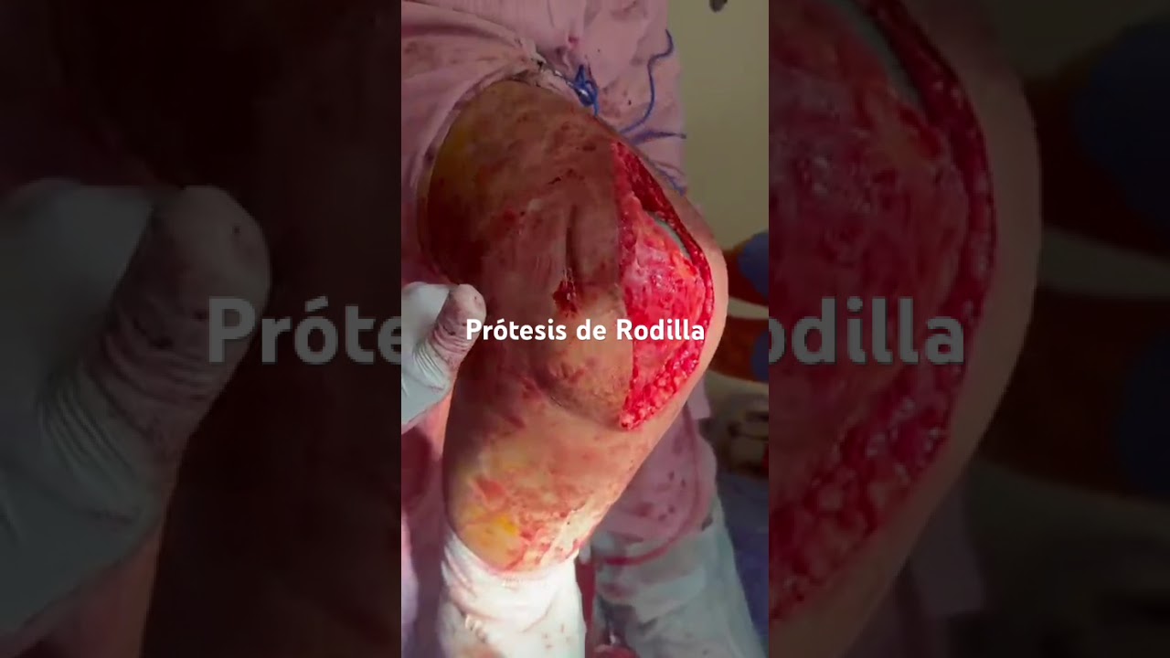 Carlos Tapia Hernández-21