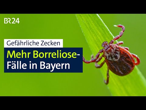 Gefährliche Zecken: Mehr Borreliose-Fälle in Bayern | BR24