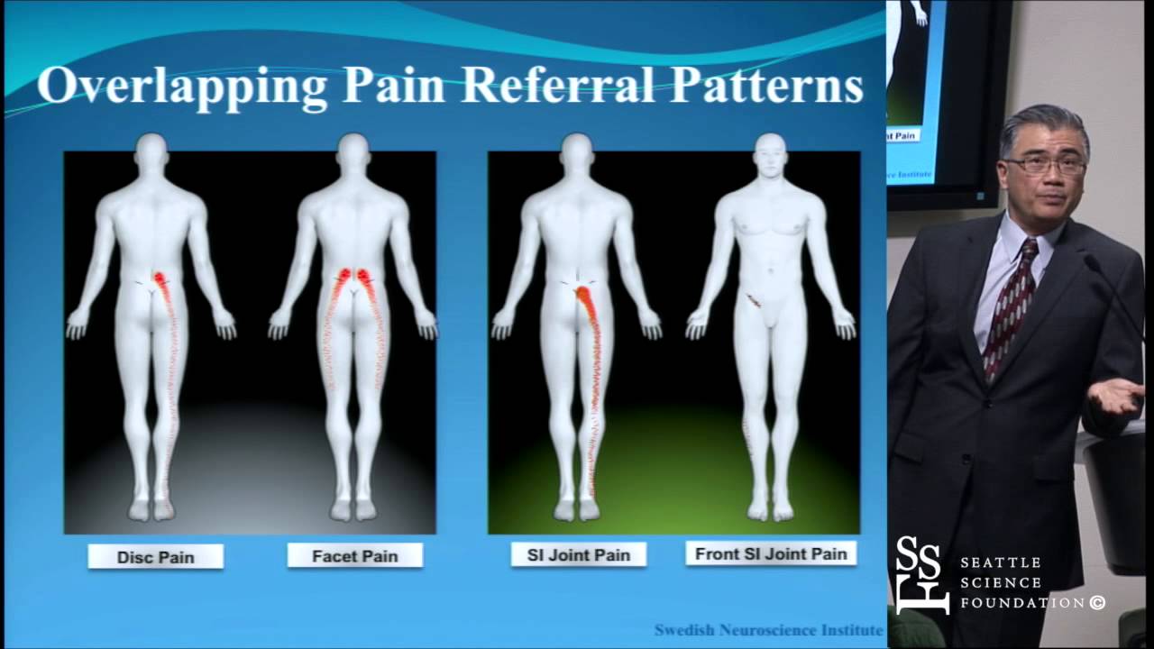 Sacroiliac Joint Pain: Diagnosis and Treatments - YouTube