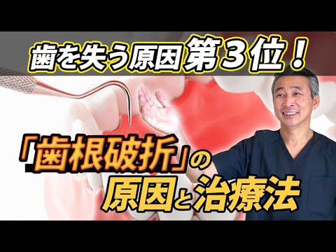歯学科 【要注意】歯を失う原因！ 第3位 歯根破折 の 原因と治療法「精密根管治療」