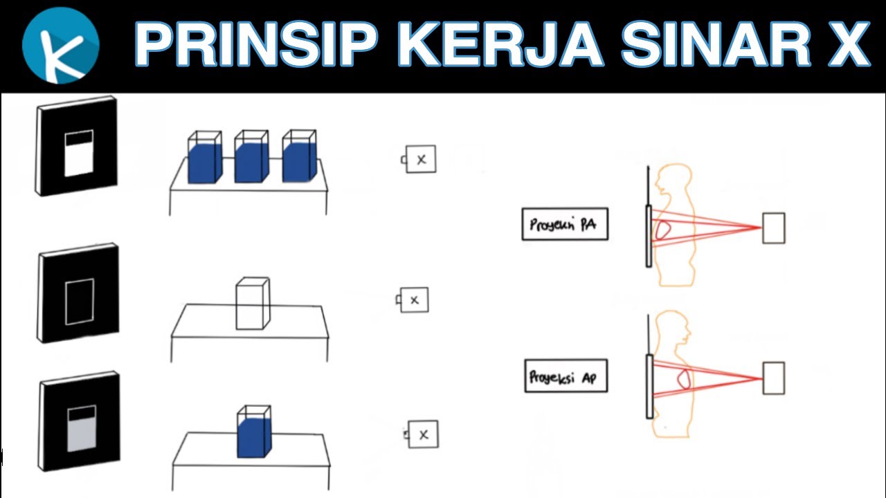 Cara Kerja Sinar X - Foto Rontgen - Radiologi (1/10)
