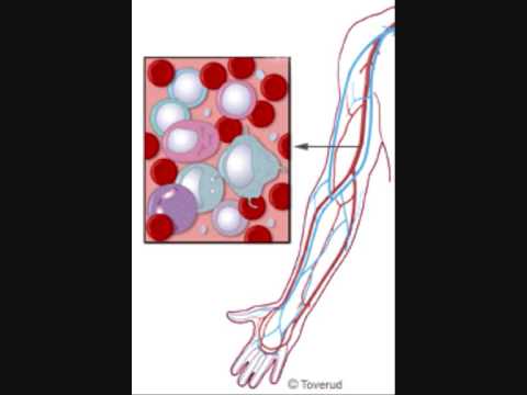 Blodomloppet av Torsson
