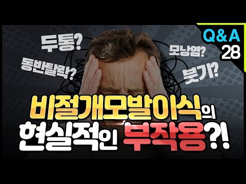 [모빈치TV] 비절개모발이식의 현실적인 부작용?! 모발이식!!