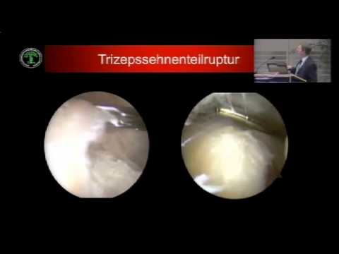 Fixierbinde Knie MRT des Sprunggelenks in den Preisen von Moskau