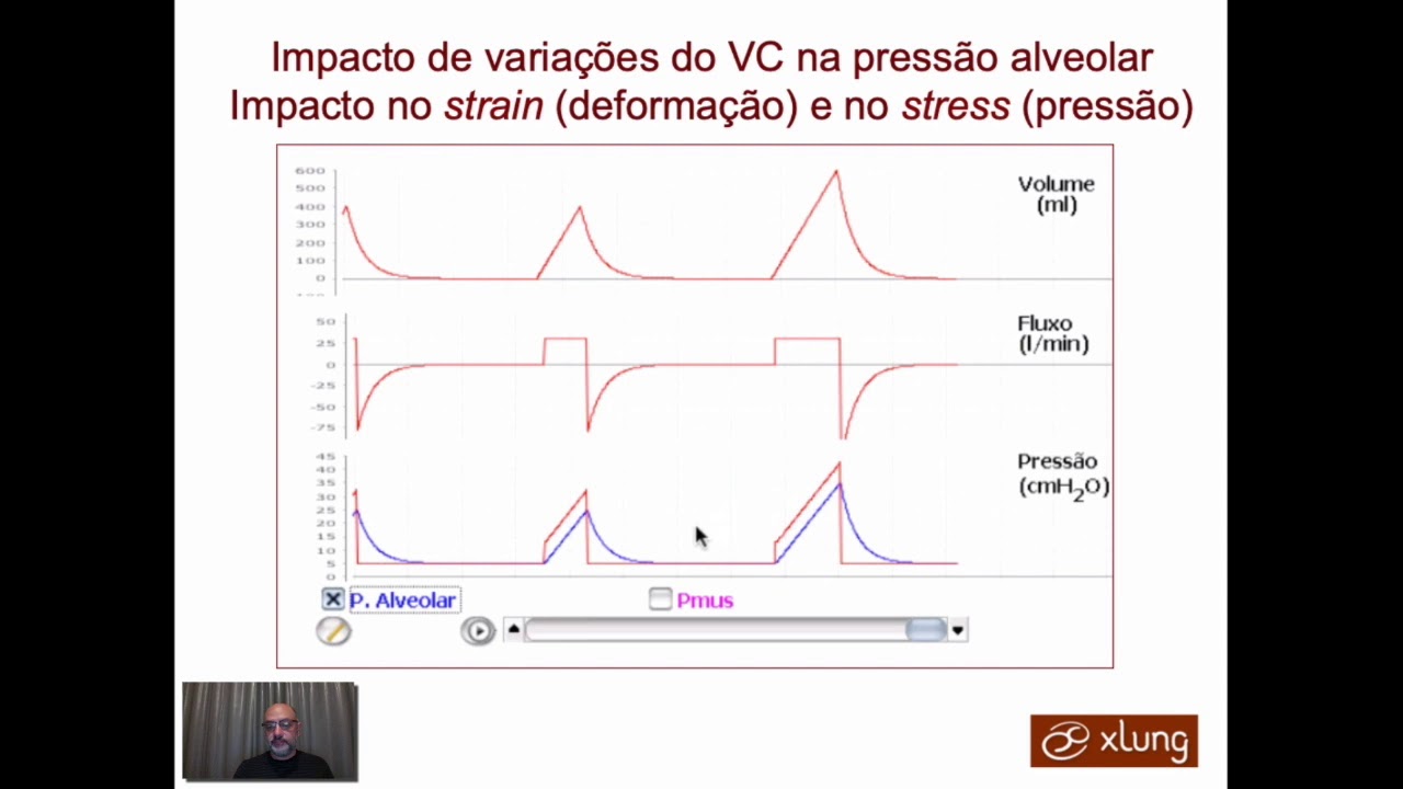 SARA   Estratégias Ventilatórias Protetoras   Parte 1