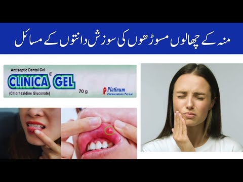 Clinica gel uses in urdu | Bleeding gums treatment | Clinica gel uses and side effects