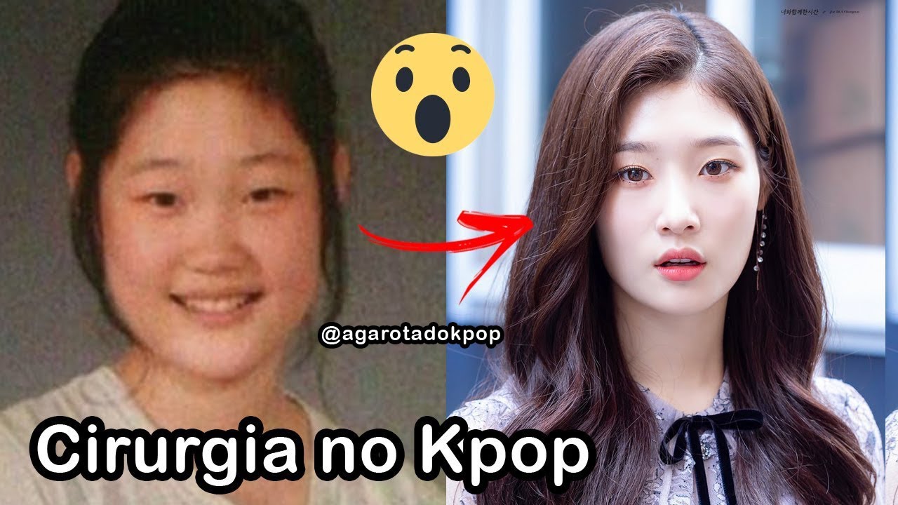 KPOP IDOLS QUE FIZERAM CIRURGIA PLÁSTICA