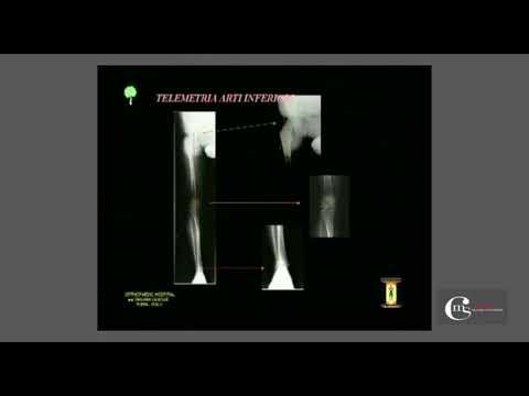 Il clarins da pigmentary nota risposte Togliere posti di pigmentary dal sole