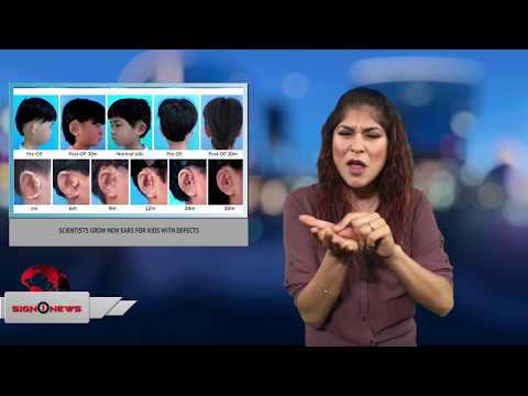 Scientists grow new ears for kids with defects (ASL 1.30.18)