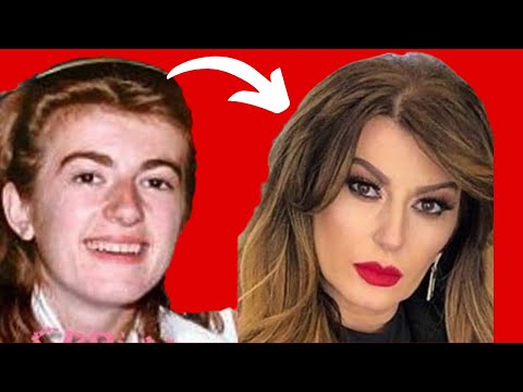 NEĆETE VJEROVATI KAKO SU IZGLEDALE PJEVAČICE PRIJE I POSLIJE PLASTIČNIH OPERACIJA! *ne liče na sebe*