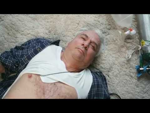  SAM IO -Intraosseous Access System | Cardiac Arrest (IO-MKb-VIDEO-01)