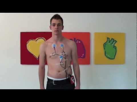 comment poser electrodes ecg