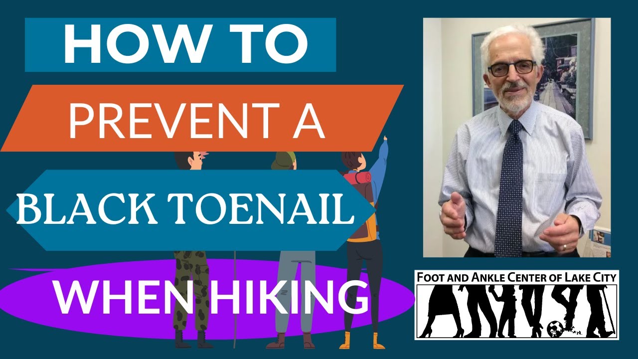 How To Prevent A Black Toenail While Hiking Foot and Ankle Center of