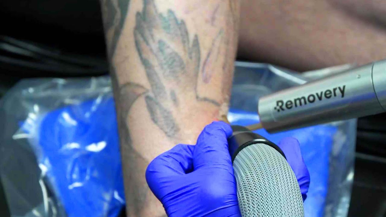 Is Tattoo Regret on the Rise?