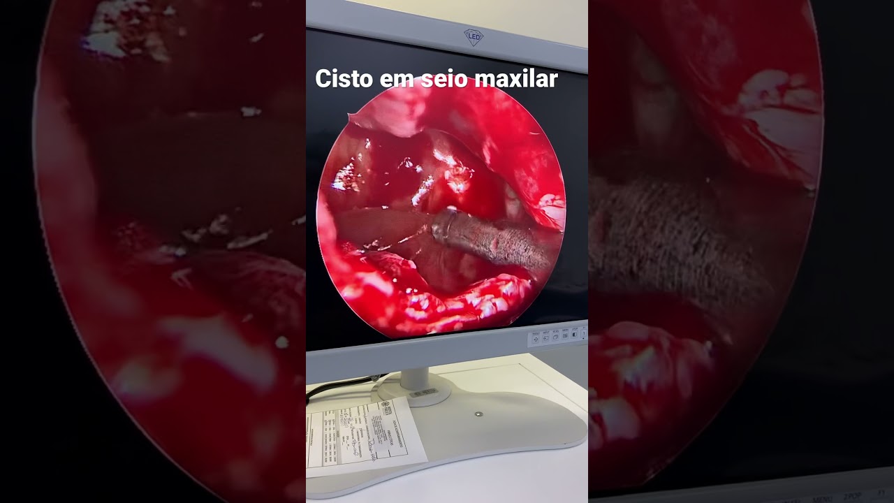 João Marcos Piva Rodrigues-25