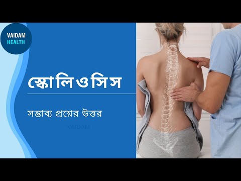 স্কোলিওসিস-প্রায়শই জিজ্ঞাসিত প্রশ্ন