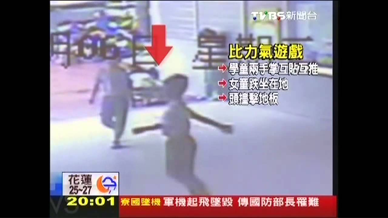 手掌互推比力氣 女童摔地「兩眼半盲」