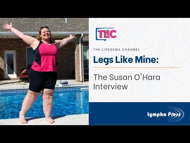 Legs Like Mine: The Susan O’Hara Interview
