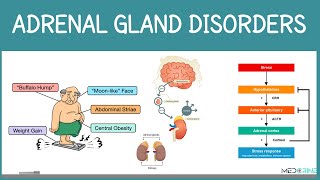 Adrenal Gland Disorders Explained | Addison’s Disease, Addisonian Crisis and Cushing’s Syndrome