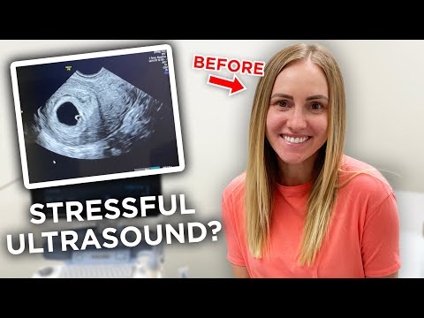 FIRST ULTRASOUND APPOINTMENT! (So Nervous)