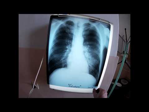 Opuszczony Szpital / Defibrylator pod napięciem / Abandoned Hospital