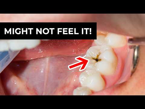 3 Ways to Tell If You Have a Cavity (Before It Hurts!)