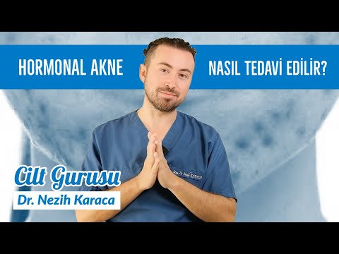 Hormonal Akne ve Tedavi Yöntemleri
