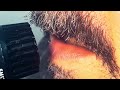 Damage Case (Official Teaser)