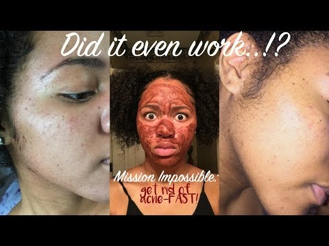 download lagu mp3 mp4 Cinnamon And Egg, download lagu Cinnamon And Egg gratis, unduh video klip Cinnamon And Egg