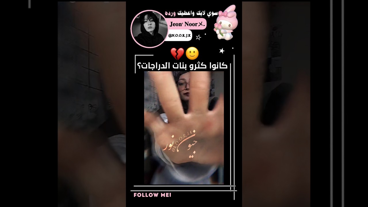 الوضع خرج عن السيطرةة🙂💔#جيش_التوليب#اكسبلور#bts#shorts#like#trend#song#fyp#fun#kpop#jk#ضحك#follow#fy