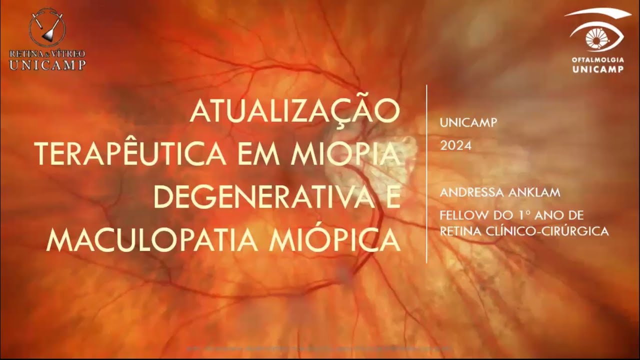 Retina e Vítreo (11/07/2024) - Atualização Terapêutica em Miopia Degenerativa e Maculopatia Miópica