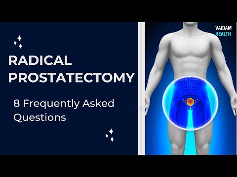 Radical Prostatectomy- 8 Frequently Asked Questions