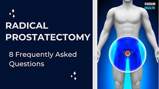 Radical Prostatectomy - 8 Frequently Asked Questions