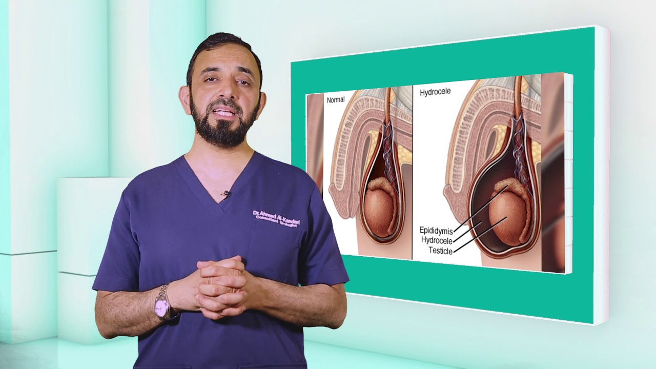 آلام و انتفاخ الخصيتين ج 2