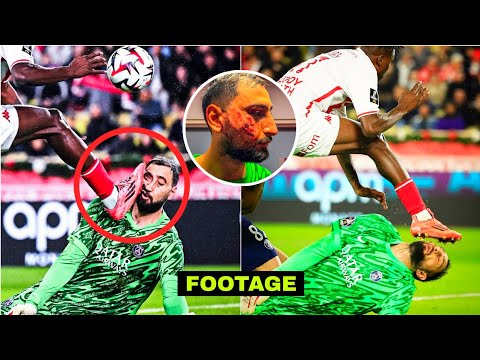 FOOTAGE & UPDATE!🤕 Psg Goalkeeper Gianluigi Donnarumma horrible injury vs Monaco
