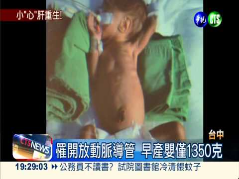 體重最輕心導管患者 2月嬰康復