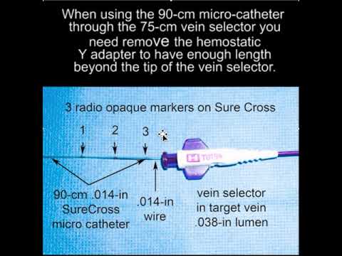 Use of a micro-catheter to advance a wire & switch from floppy to stiff wire