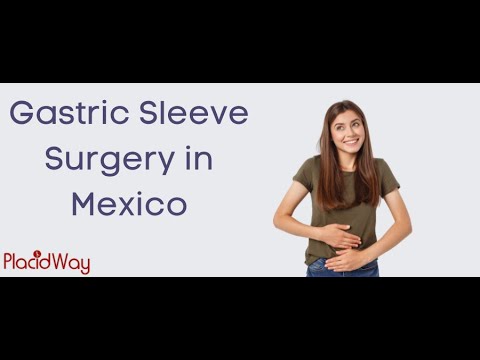 Gastric Sleeve Surgery in Mexico with High Quality Care