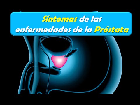 Trattamento magnitor di prostatite Alcuni farmaci là per la prostata