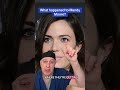 What’s up with Mandy Moore?  Looks like she may have undergone an upper lid blepharoplasty.