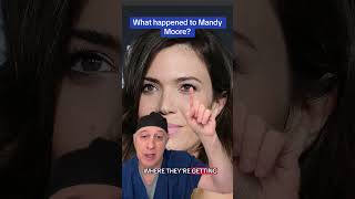 What’s up with Mandy Moore?  Looks like she may have undergone an upper lid blepharoplasty.