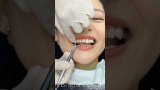 Get your perfect smile with VBright Dental in China🇨🇳