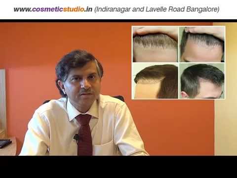 Hair Transplant In Bangalore