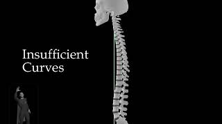 Insufficient Curves - Skull and Spine