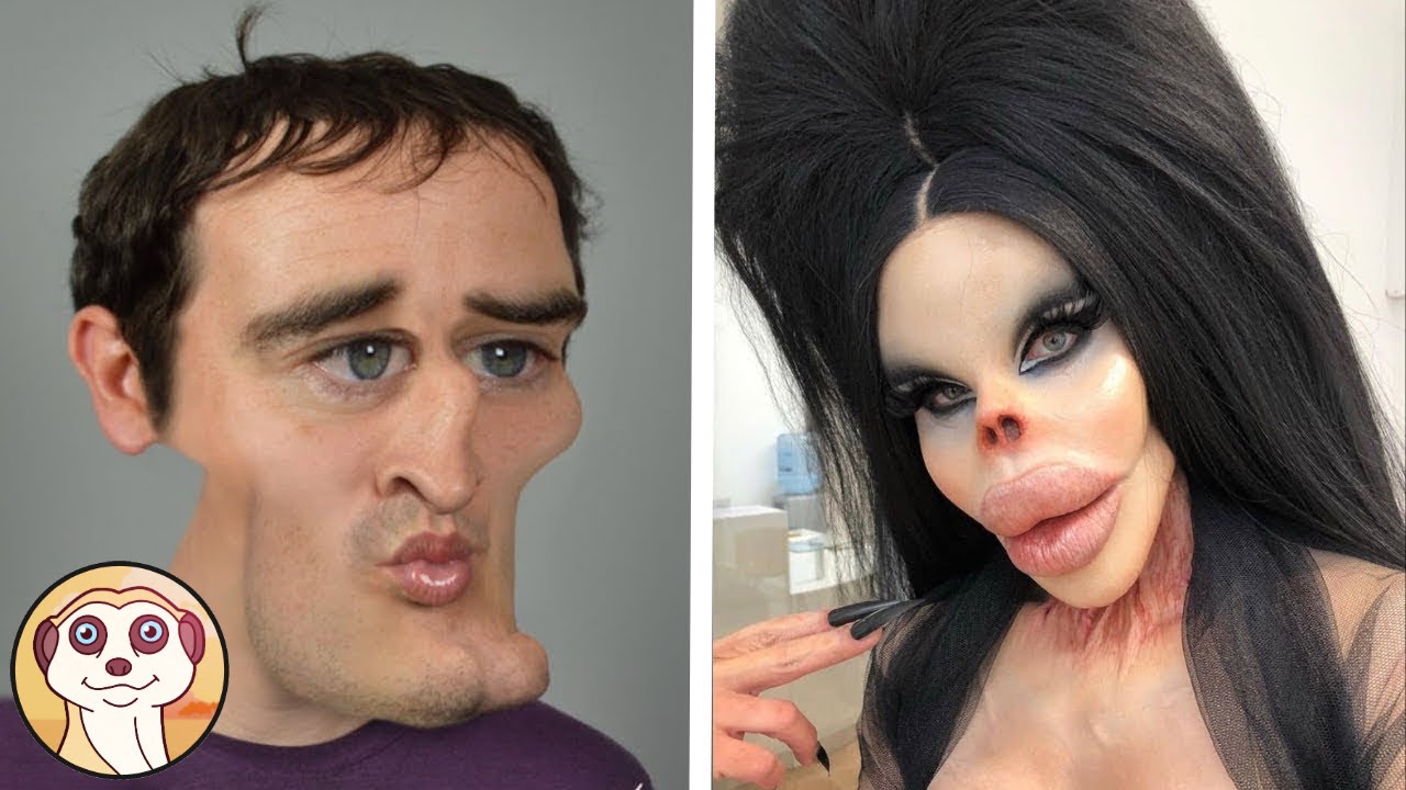 Watch Now VIP SFIGURATI DALLA CHIRURGIA ESTETICA VIP SFIGURATI DALLA CHIRURGIA ESTETICA