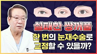실패한 쌍꺼풀, 한번의 눈재수술로 교정하는 방법은?
