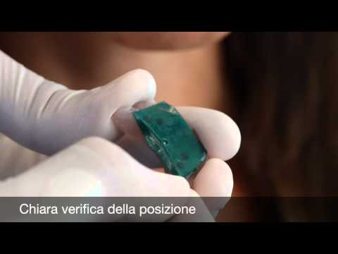 Candulor Registration Set CRS 20