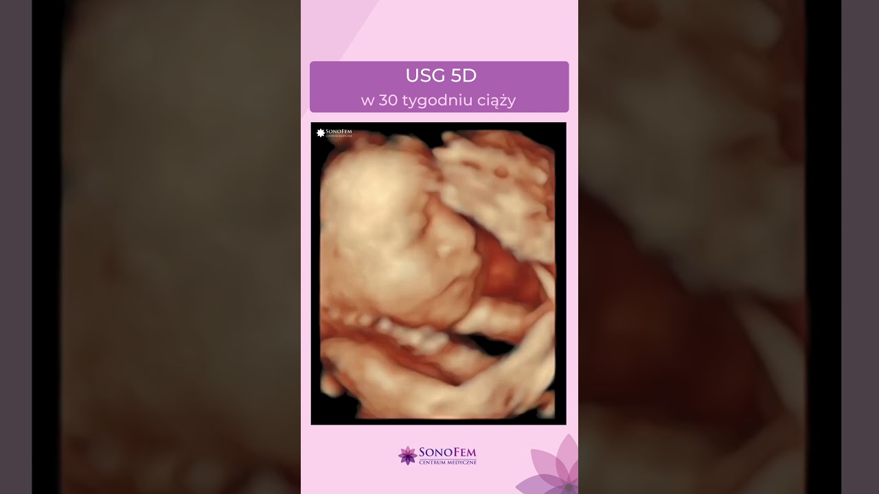 Anita Hamela-Olkowska-5